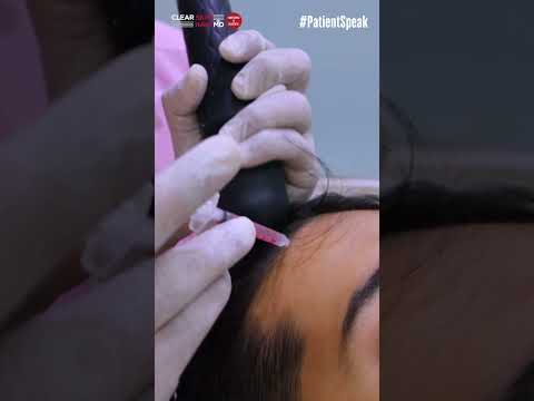 PRP Therapy Works! Real Patient Testimonial | Hair Loss Treatment | HairMD Clinic, Pune