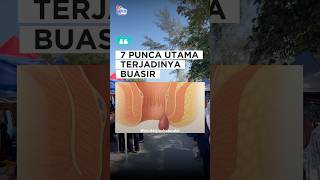 7 PUNCA UTAMA BUASIR | BUASIR BERDARAH | BERAK BERDARAH