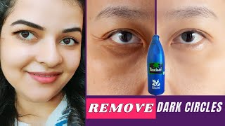 How to Remove Dark Circles Naturally in 3 Days with Coconut Oil (100% Results) | Remove Dark Circles