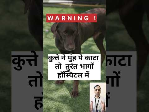 कुत्ते ने मुंह पे काटा तो तुरंत भागों हॉस्पिटल में #dogbites#rabbis#antirabiesvaccine