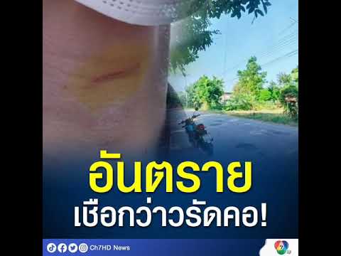 #เตือนภัย หนุ่มขี่ จยย. กลับบ้านเจอ #เชือกว่าวรัดคอ เป็นบาดแผล
เข้าลงบันทึกประจำวัน แฟนเจ้าของว่าววิ