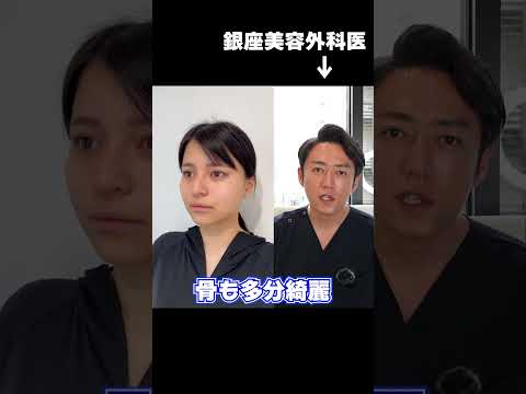 【小顔整形】脂肪吸引で美人に変身！😊#shorts