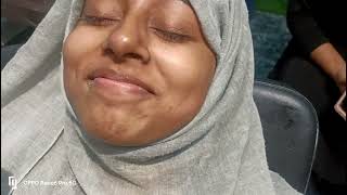 asmr upper lips waxing and threading hair removal how to remove hair