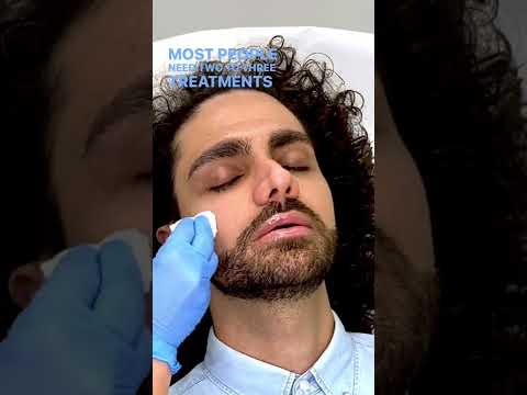 Undereye circles got you down? Brighten your eyes using this amazing treatment