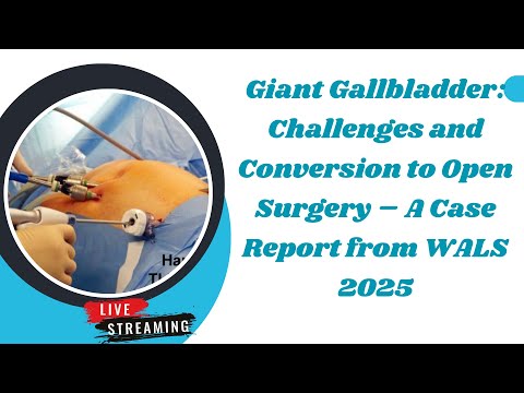 Giant Gallbladder: Challenges and Conversion to Open Surgery – A Case Report from WALS 2025