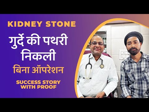 गुर्दे की पथरी निकली Success Story Kidney Stone Removed With Proof