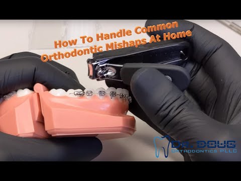 How to handle orthodontic emergencies at home