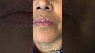 #shortsvideo Upper lips waxing on sensitive skin/#waxingtips #ricawax #wax@pummybeautyworld