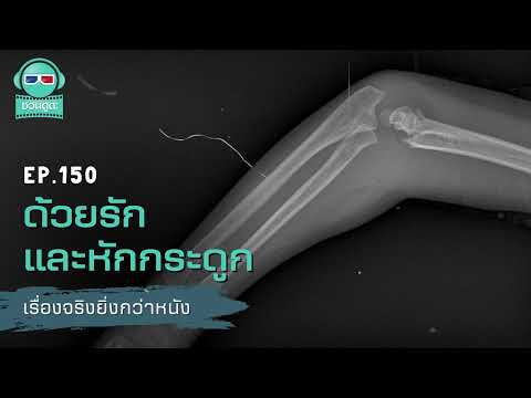 ด้วยรักและหักกระดูก - เรื่องจริงยิ่งกว่าหนัง PODCAST EP150