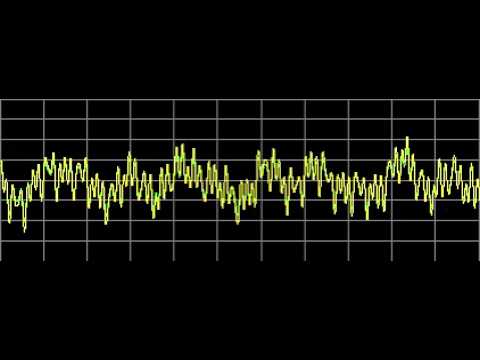 Myoclonus - Rife Frequencies