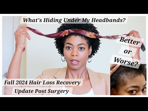 What's Hiding Under My Headbands? - Fall 2024 Hair Loss Update - 4C Natural Hair - NaturalMe4C