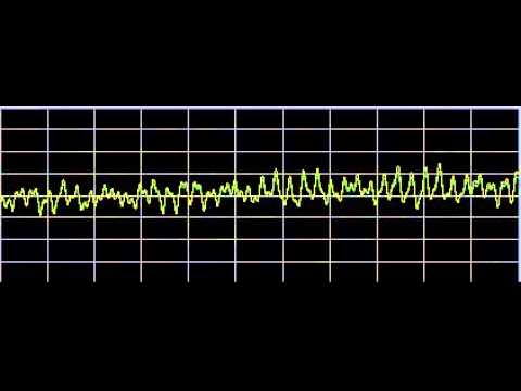 Shingles - Rife Frequencies