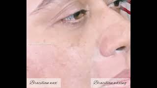 Brazilian waxing @ Brazilian wax @ how to remove  upper lips waxing@ how to remove facial hair