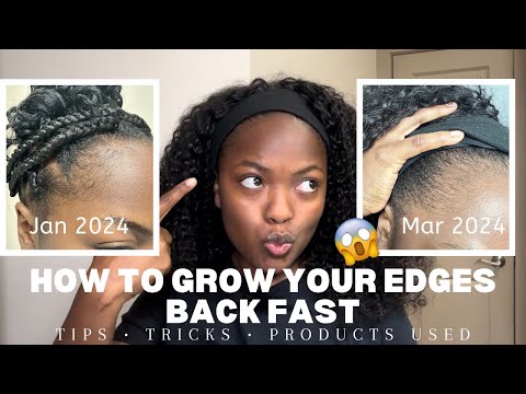 How I Regrew My Edges In Just Three Months | Edge Growth Journey✨