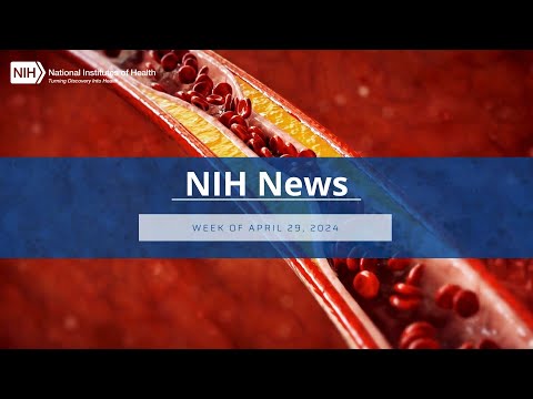 NIH News – Week of April 29, 2024