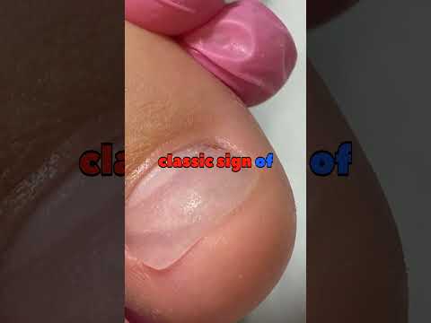 Your nails are screaming for help — but are you listening?