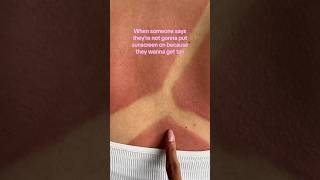 POV: ME REMEMBERING TO PUT ON SUNSCREEN☀️#cocoandeve #sunscreen #spf #sunburn #tanning #summer