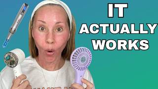 Microneedling for Mature Skin-- Full Tutorial and Honest Results
