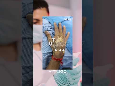 Skinaa Clinic | Your Solution for Skin & Hair Problems | Patient Feedback #viral #shorts