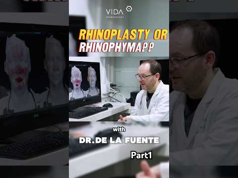 Rhinophyma 🤔 understanding the condition with Dr.De la Fuente Pt.1 ✨ #dermatologist #isotretinoina