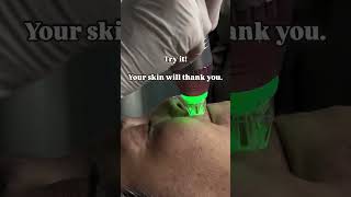 Tighter skin, minimized pores, and a youthful glow—RF Microneedling #skinrejuvenation #rfmicroneedle