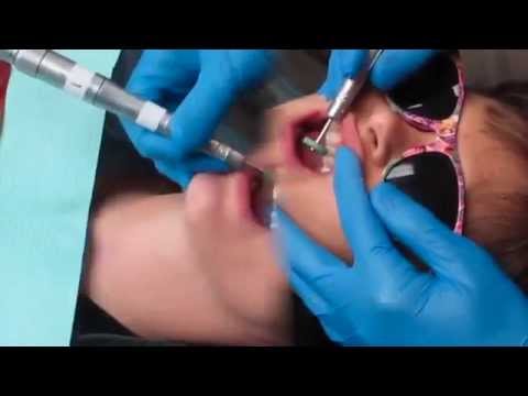 Enamelplasty