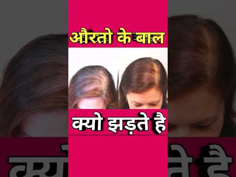 Reason for Hairfall in women|औरतो के बाल क्यो झड़ते है| credit-@rajshamani #hairfall #women