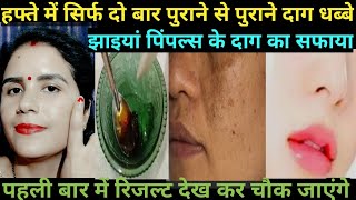 एलोवेरा से दाग-धब्बे कैसे हटाए🤔 || How To Remove Dark Spot From Face || Face Ke Daag Dhabba