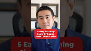 5 Early Warning Signs of Lupus