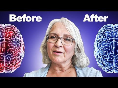 SHOCKING Results From Tinnitus Neuroplasticity: Linda’s Story