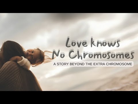 Understanding Down Syndrome: A story of Hope from Calicut medical College❤️🩺