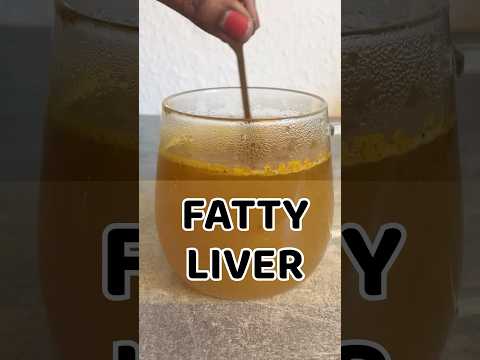 Best Home Remedy For Fatty Liver  | Fatty Liver Detox Drink Recipe #shorts #viralvideo #health