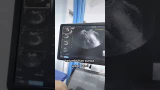 Ketumbuhan bahaya tau