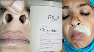 Upper lips waxing with Rica wax and nose hair cutting/#piggynose#Upperlipswaxing#nosehaircutting