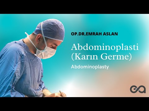 Abdominoplasti Hakkında En Çok Merak Edilen Sorular / KARIN GERME