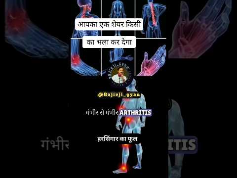 Arthritis problem rajiv dixit #rajivdixit #ayurveda #harsingar #ratrani #ayurvedikupchar