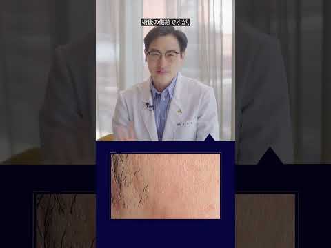 【大人ニキビ】 韓国のお肌職人が教えてくれるニキビ跡をなくす方法。ぜひ見てください！