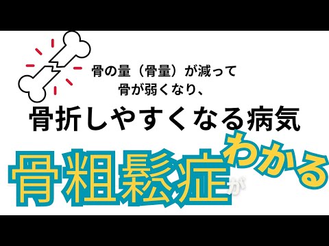 【骨粗鬆症】骨を硬くしたいひとはこの動画を見てください