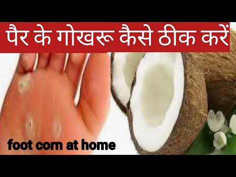 पैर के गोखरू कैसे ठीक करें l foot corn kaise hota hai l foot corn removal at home