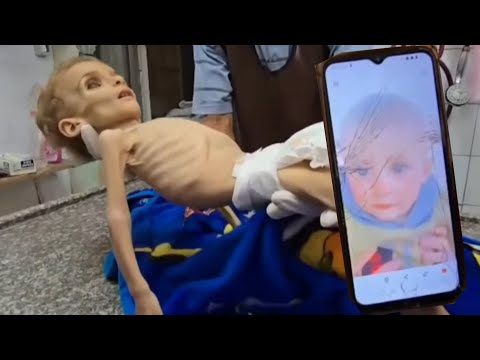 世界が見落とした命：ガザの幼い少女、サナ・アル・ラハムちゃんの叫び