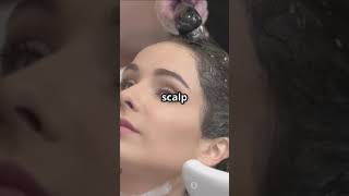 How to remove dandruff quickly at home?#healthyscalp #homeremedies #haircare #dandruffcontrol #hair