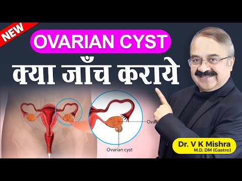 OVARIAN CYSTS क्या जाँच कराये || ARE OVARIAN CYSTS CANCERS