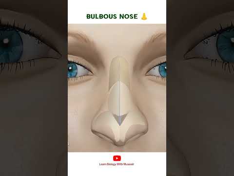 BULBOUS NOSE 👃 | Cosmetic Surgery