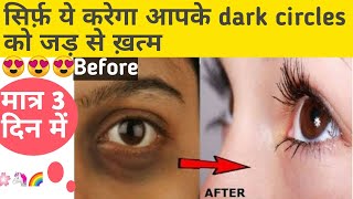 There is no easier solution than this to eliminate dark circles from the roots. Dark circle home ...