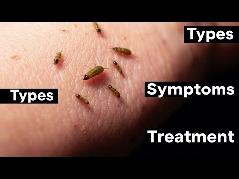 🦠 Maggots Myiasis Infestation | Types, Symptoms, and Treatment 🐛
