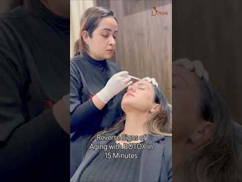 Reverse Signs of Aging | Smooth Forehead Lines & Frown Wrinkles Instantly with BOTOX! #ytviral