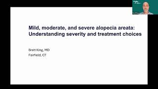 Mild, moderate, and severe alopecia areata Understanding severity and treatment choices