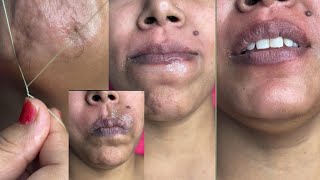 Upper lips waxing tutorial/How to do upper lips waxing/ #lips #hairremoval #pummybeautyworld #beauty