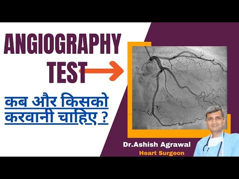 Angiography Test  कब और किसको करवानी चाहिए  |  Angiography Test | #coronary  Angiography Procedure