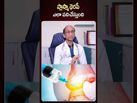 ప్లాస్మా థెరఫీ ఎలా పనిచేస్తుంది.. | PRP Treatment | SumanTV